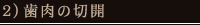 2）歯肉の切開